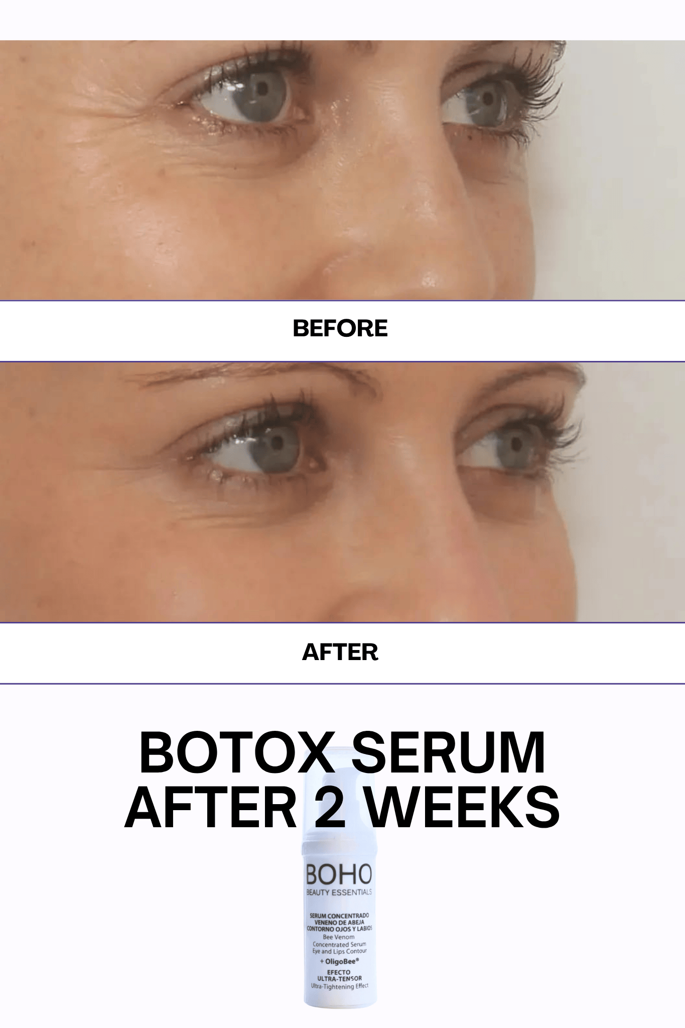 Botox Serum - Bee Venom 30 mL