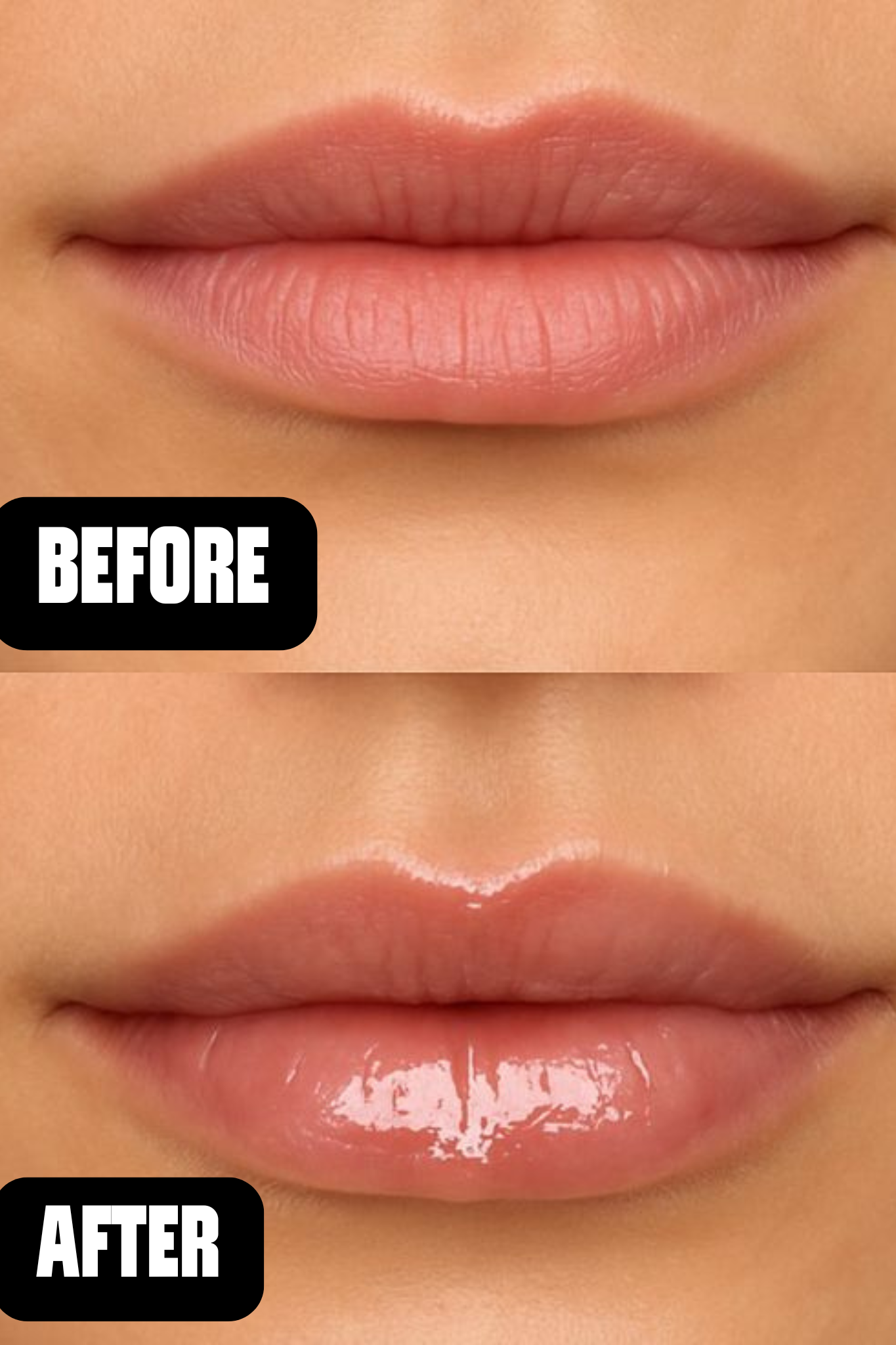 Revox Lip Filler Hyaluronic Acid